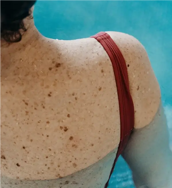 Крупный план загорелой, веснушчатой ​​спины и плеча женщины в красном купальнике на фоне ярко-голубой воды бассейна.