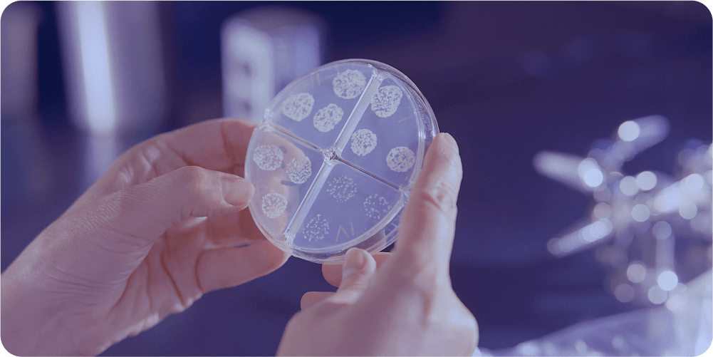 Руки держат чашку Петри с небольшими круглыми бактериальными культурами, разделёнными на четыре секции. Сцена создаёт научную и сосредоточенную атмосферу.